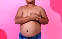 Vô địch... béo phì