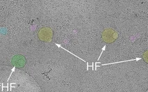 Phát hiện cấu trúc hoàn toàn mới bên trong tế bào người