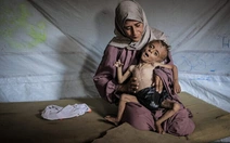 Bức ảnh cậu bé gầy trơ xương vì đói ở Gaza bị tố là ảnh giả