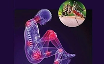 Dịch Chikungunya lan rộng liệu có nguy hiểm?