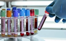 Tại sao người gầy, ít ăn dầu mỡ nhưng mỡ máu vẫn cao?