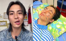 Lãnh Thanh gây cười khi chỉ cách tránh liệt dây thần kinh số 7