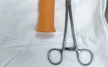 Thanh niên nhét cán cây lau nhà vào hậu môn, trôi sâu đến trực tràng