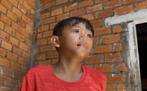 Bé trai hàng xóm nhanh trí cứu sống nạn nhân nhỏ tuổi nhất trong vụ thảm án ở Đắk Lắk