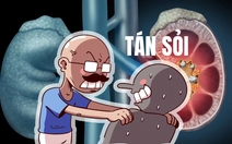 Đắk Lắk: Tán sỏi cho 480 bệnh nhân dù máy đã hỏng 2 năm