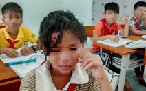 Học sinh bán trú đồng loạt không đi học sau vụ ngộ độc, phụ huynh nói ‘không yên tâm’