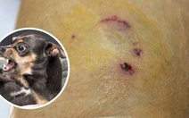 Bốn người trong gia đình bị chó cắn nhưng không tiêm phòng, một người tử vong