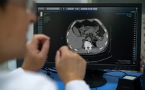 Trung Quốc quyết liệt đưa AI vào chẩn đoán bệnh, những câu hỏi đặt ra