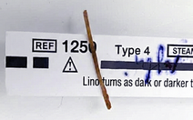 Nuốt que xiên nhỏ gây hậu quả lớn