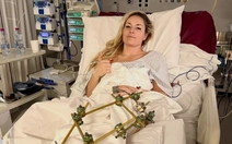 'Nữ hoàng tốc độ' có nguy cơ phải cắt cụt chân sau tai nạn tại Olympic