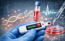 Que thử ung thư siêu nhạy, phát hiện dấu hiệu bệnh từ nồng độ cực thấp