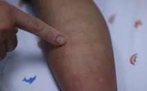 Sốt xuất huyết Dengue và những dự định dở dang bên giường bệnh