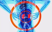 Sống chung với bệnh thận mạn: Điều trị đúng để kéo dài chất lượng sống