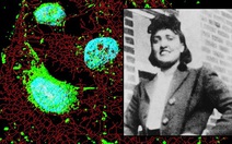 Người phụ nữ qua đời 70 năm nhưng 'tế bào bất tử' vẫn cứu hàng triệu người
