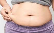 Béo phì không chỉ do 'ăn nhiều - ít vận động'