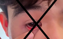 Chiêu trò lôi 'ký sinh trùng' ra từ mắt