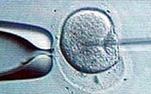 IVF gây căng thẳng cho nhiều người