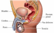 Bệnh ung thư tuyến tiền liệt