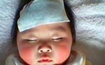 Làm gì khi trẻ bị sốt virus?
