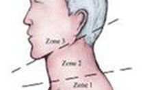 Thoái hóa cột sống cổ: điều trị và phòng ngừa