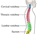 Phẫu thuật cong vẹo cột sống cho bệnh nhi