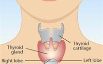 Bệnh tuyến giáp gây rối loạn kinh nguyệt