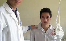 Nối phần chi thể đứt rời