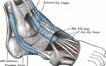 Xương bàn chân lâu hồi phục