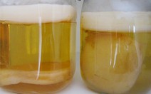 Trà kombucha và sức khỏe