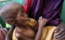 Đông Phi đói khủng khiếp