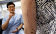Người giàu thúc đẩy du lịch y tế ở châu Á