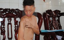 Làm rõ phản ánh  công an đánh trẻ vị thành niên