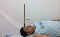 Trộm chó bắn chĩa ghim giữa trán người đuổi bắt