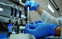 Tìm ra cách mới chữa HIV