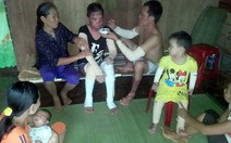 ​Cháy nhà, bỏng cả gia đình