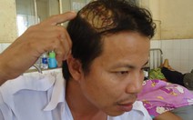 Đôi nam nữ thuê taxi, chém trọng thương tài xế