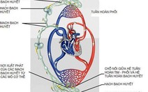 Hạch cổ có phải là ung thư?