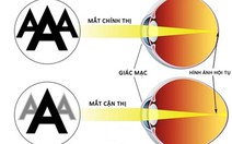 ​Tật khúc xạ học đường và cách phòng tránh