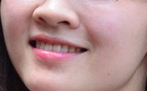 Gây tai biến, một cơ sở làm đẹp  trốn thanh tra