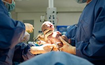 Trẻ sinh mổ dễ béo phì?