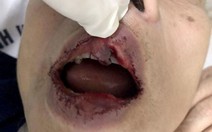 Cần xử nghiêm vụ cựu giảng viên đại học bị đánh