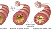 ​Lựa chọn kháng sinh trong điều trị bệnh viêm phế quản cấp