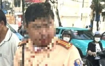 Đang làm nhiệm vụ, trung tá cảnh sát giao thông bị người đàn ông nước ngoài đấm vào miệng