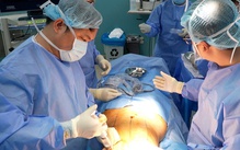 Thủng ruột, nhiễm trùng, trầm cảm là biến chứng thường gặp phẫu thuật thẩm mỹ hiện nay