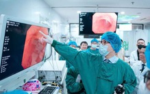 Khi nào người trẻ nên đi nội soi tiêu hóa?