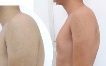 Cổ rụt, lưng gù vì ngồi vẹo vọ, bò dài trên bàn: Chữa thế nào?