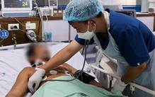 Cứu sống người đàn ông bị ong vò vẽ đốt 150 vết