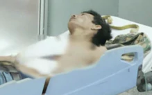 Giết vợ rồi trèo lên ngọn dừa trốn, người đàn ông đang được chữa trị 6 vết thương ở bụng