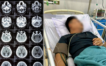 Bác sĩ cảnh báo có thể chết trên đường, vợ vẫn đưa chồng vượt 1.000km về Việt Nam giành lại sự sống