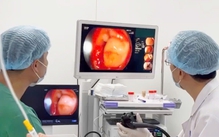 Trẻ xuất huyết tiêu hóa tăng, nhiều phụ huynh nhầm với đau bụng thông thường
